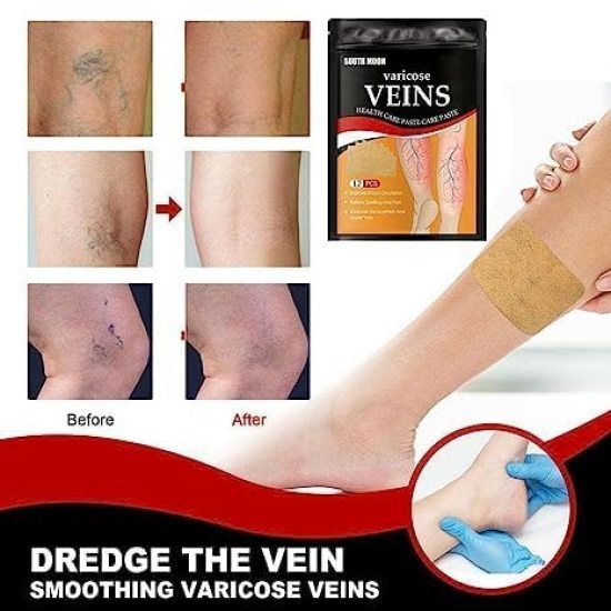 Varicose Veins Patches 12 pcs Personal Care