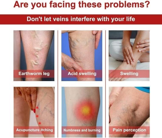 Varicose Veins Patches 12 pcs Personal Care