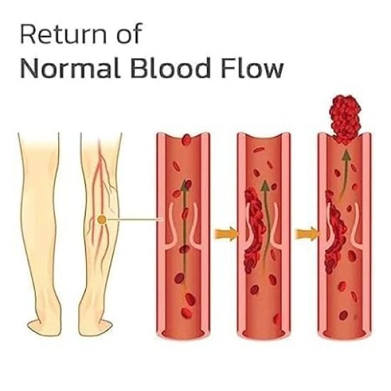 Varicose Veins Patches 12 pcs Personal Care