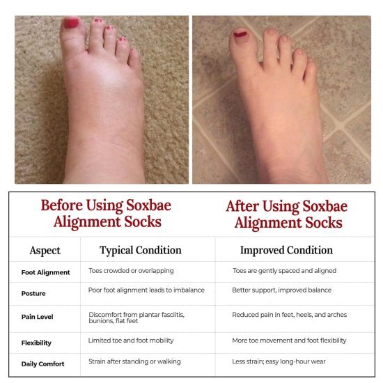 Foot Alignment Socks Personal Care