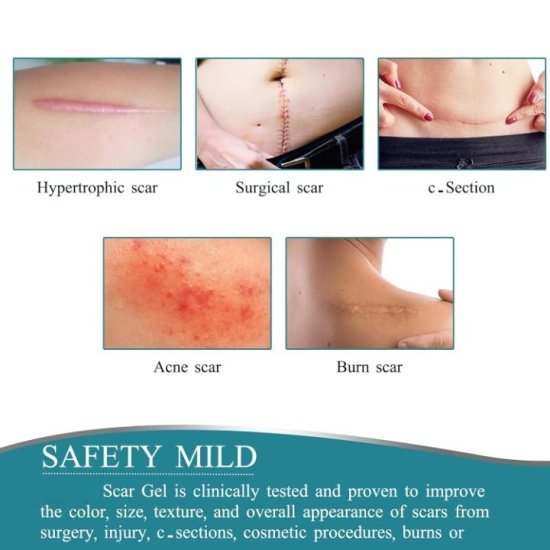 Silicone Scar Removal Sheet Personal Care