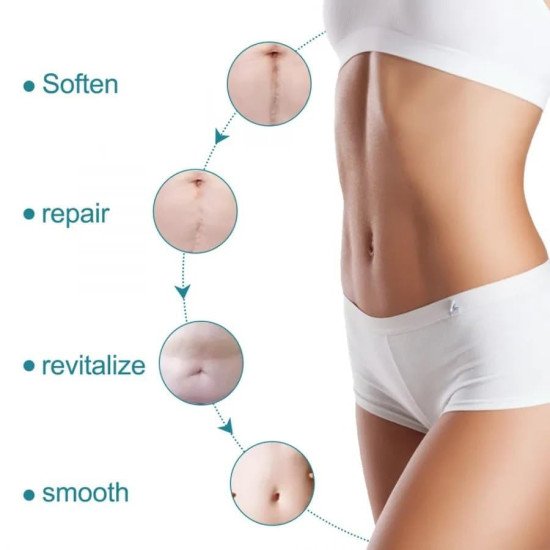 Silicone Scar Removal Sheet Personal Care