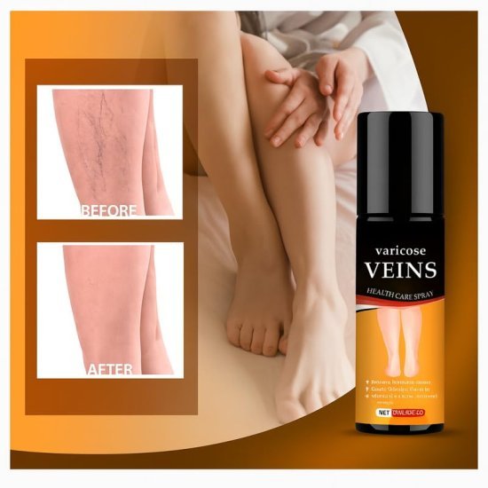 Varicose Veins Spray 30 Ml Personal Care